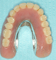 The image shows a partial denture with visible teeth, set against a blue background, with a focus on the upper front tooth.