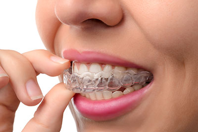 The image shows a person s hand holding a toothbrush with bristles near their mouth, which is open slightly with teeth visible, and they appear to be applying dental floss while wearing clear aligners.